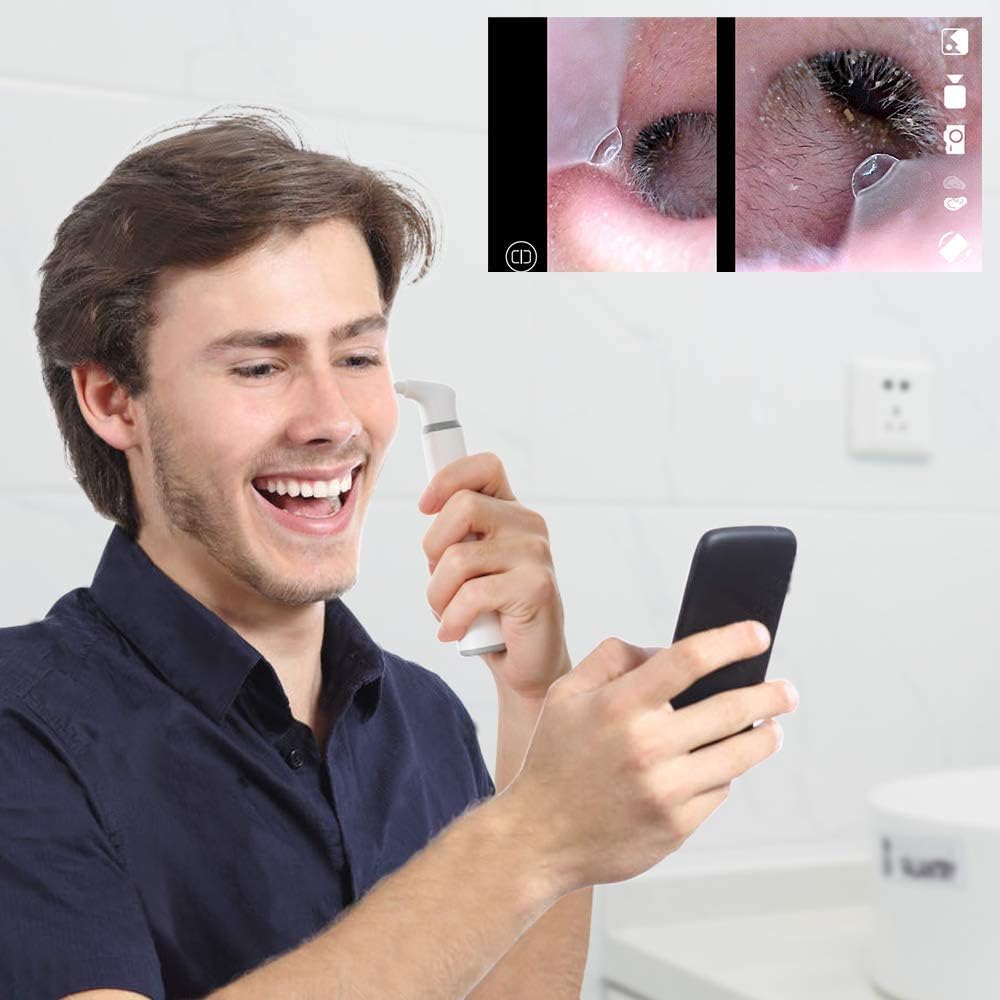 3.9mm Ultra-Thin WiFi Ear Scope Camera with 6 LED Lights V934